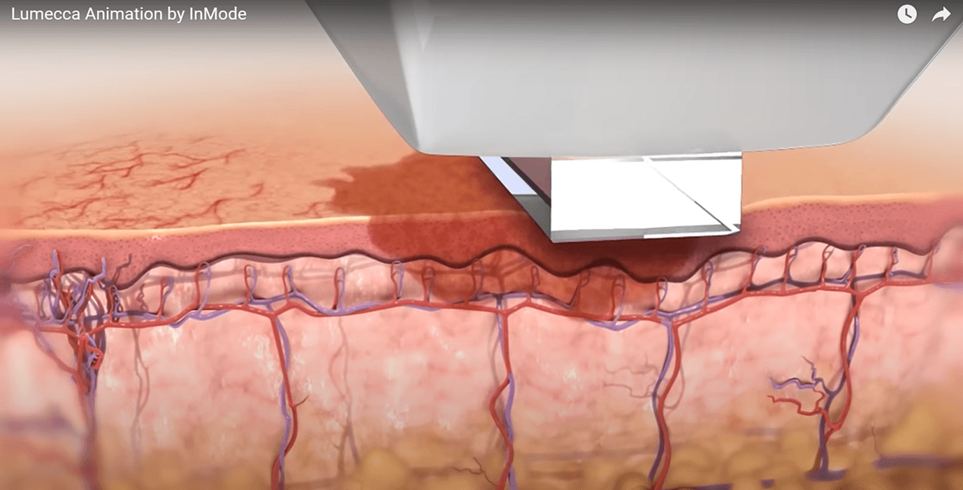 Lumecca Animation by in Mode