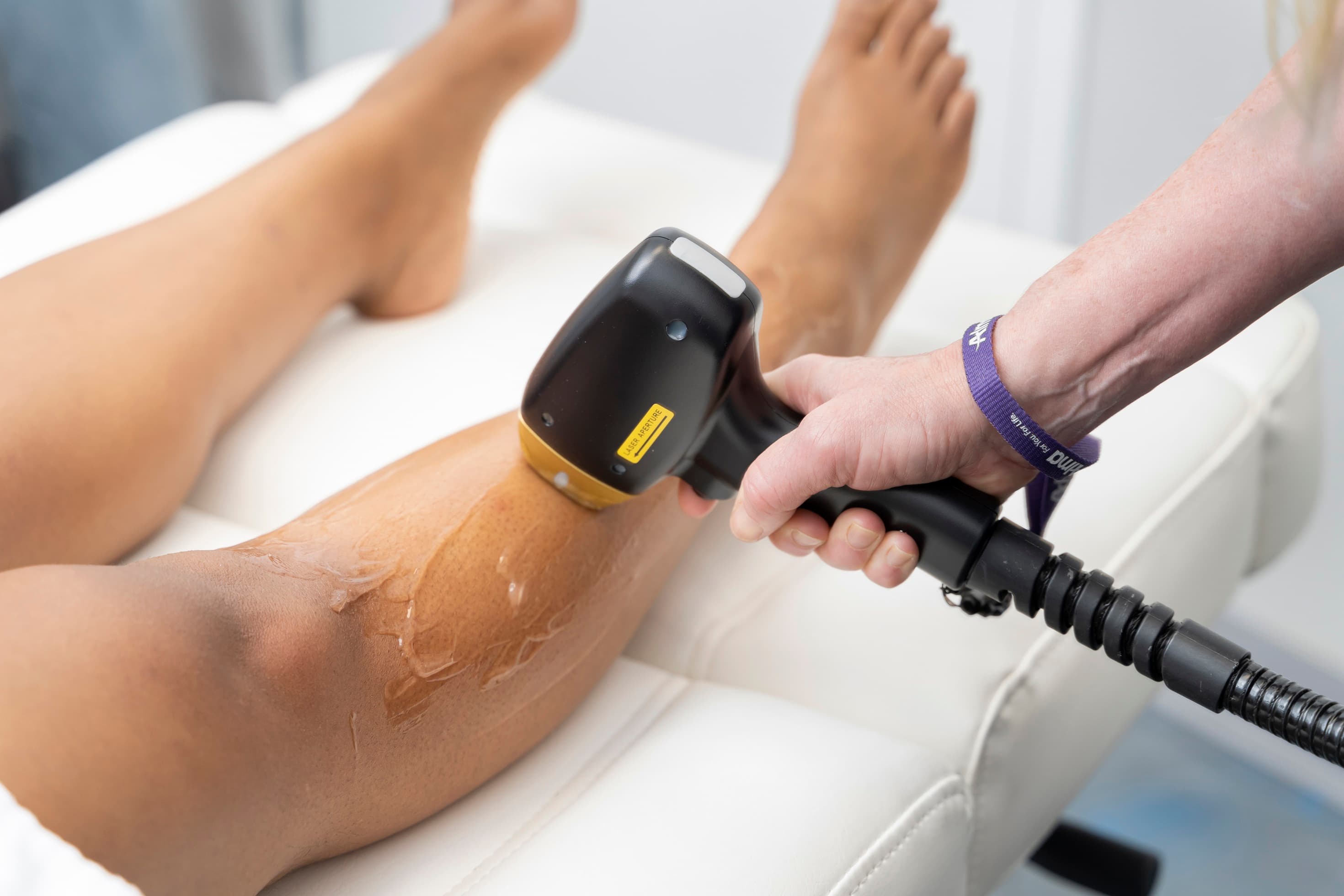 LASER Hair Removal (2)